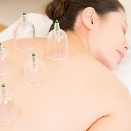 Cupping